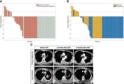 Evaluation of the efficacy and feasibility of concurrent weekly docetaxel-nedaplatin and hypo-fractionated radiotherapy in atypical histologic subtypes of primary and metastatic mediastinal malignancies